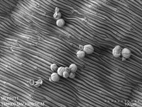 NEW, Microscopic images